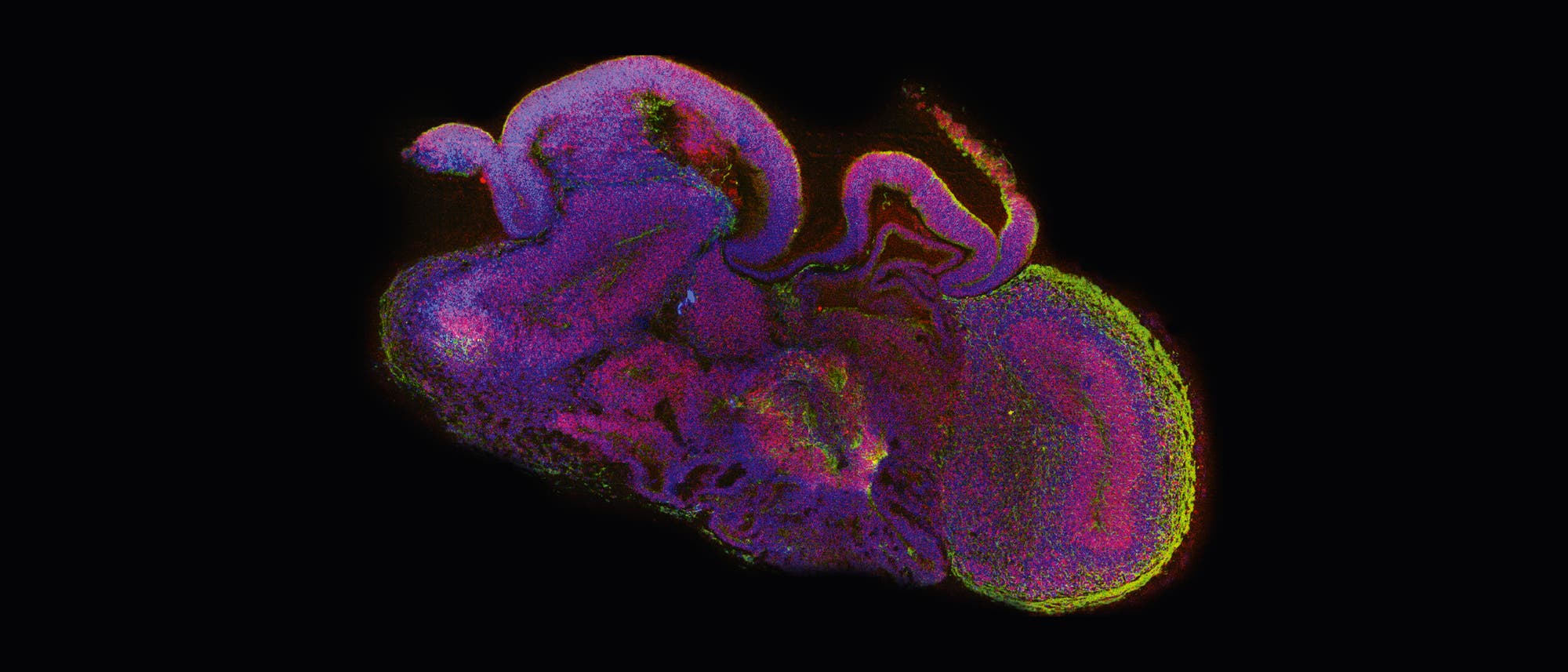 Organoid Organoid