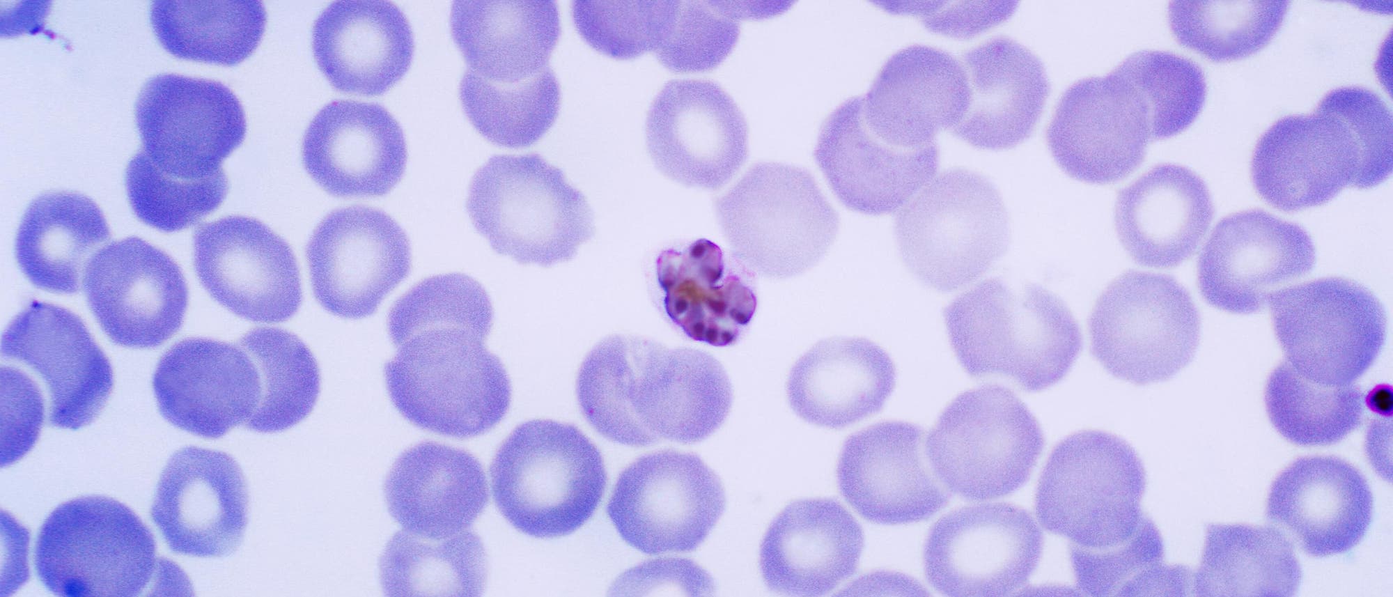 Malaria-Parasiten in roten Blutkörperchen Malaria-Parasiten in roten Blutkörperchen