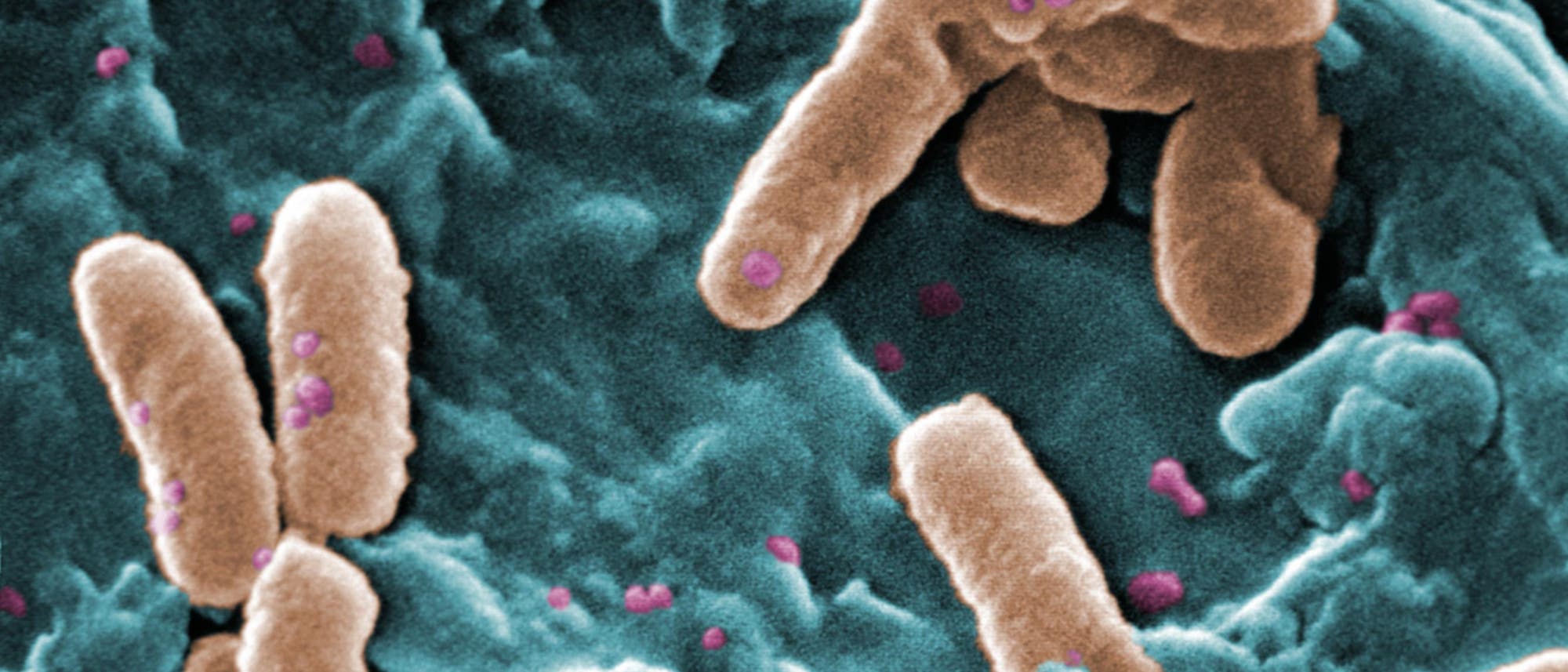 Pseudomonas aeroginosa Pseudomonas aeroginosa