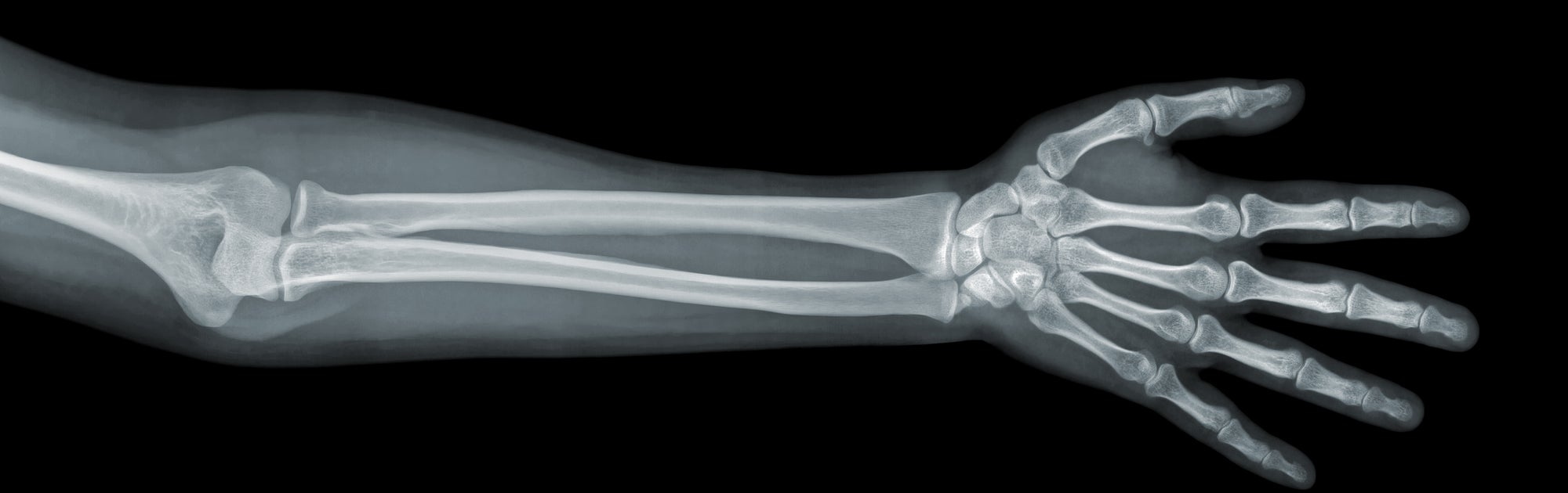 Altersermittlung: Wie lässt sich das Alter feststellen? Altersermittlung: Wie lässt sich das Alter feststellen?