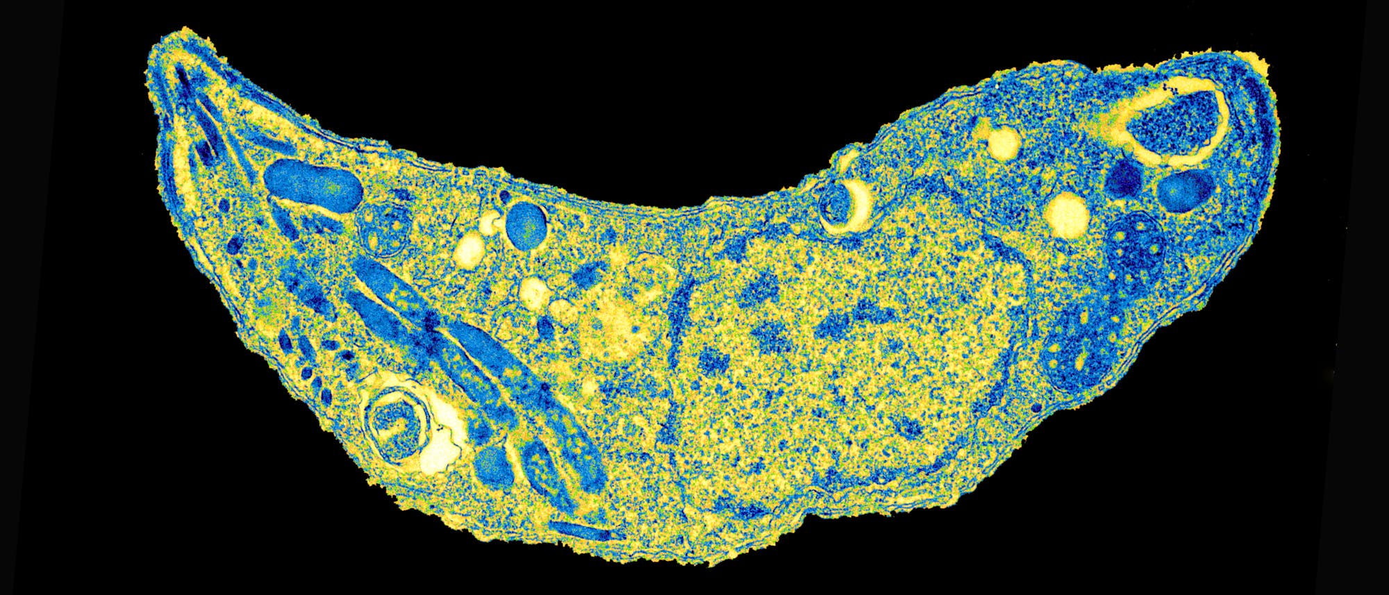 Toxoplasma gondii, 30 000-fach vergrößert Toxoplasma gondii, 30 000-fach vergrößert