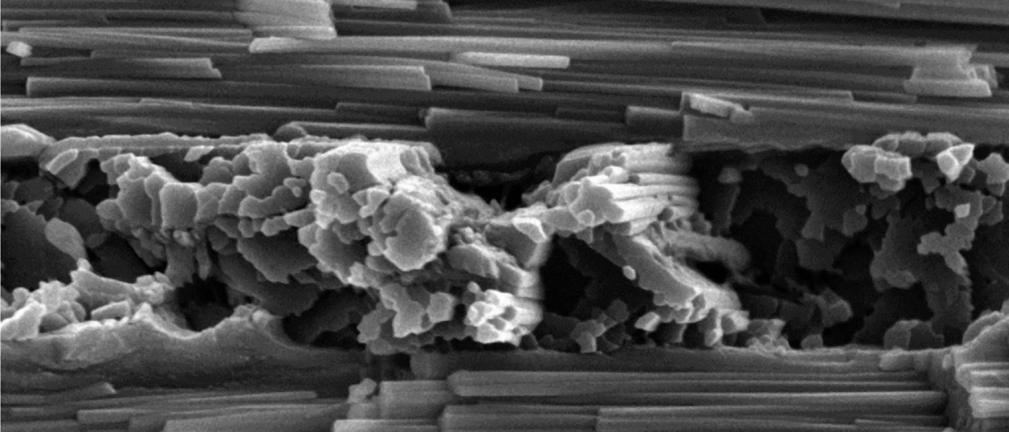 Biomimetischer Zahnersatz Biomimetischer Zahnersatz