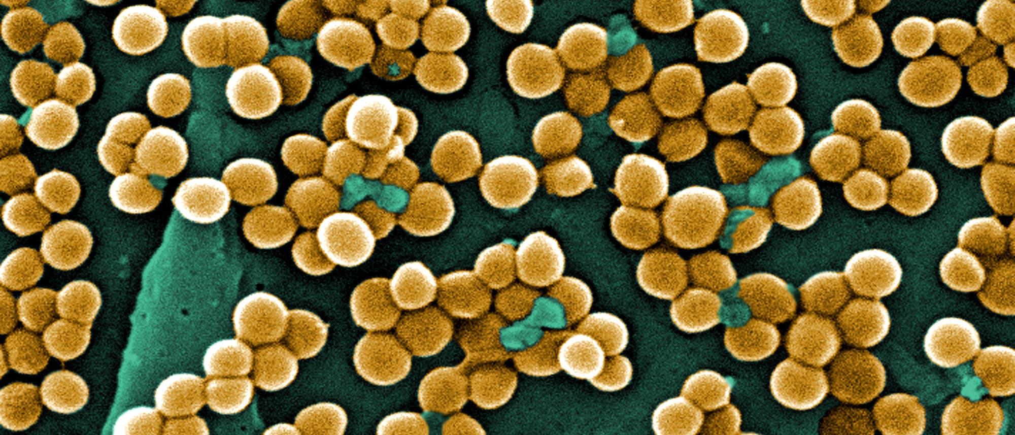 Staphylococcus aureus Staphylococcus aureus