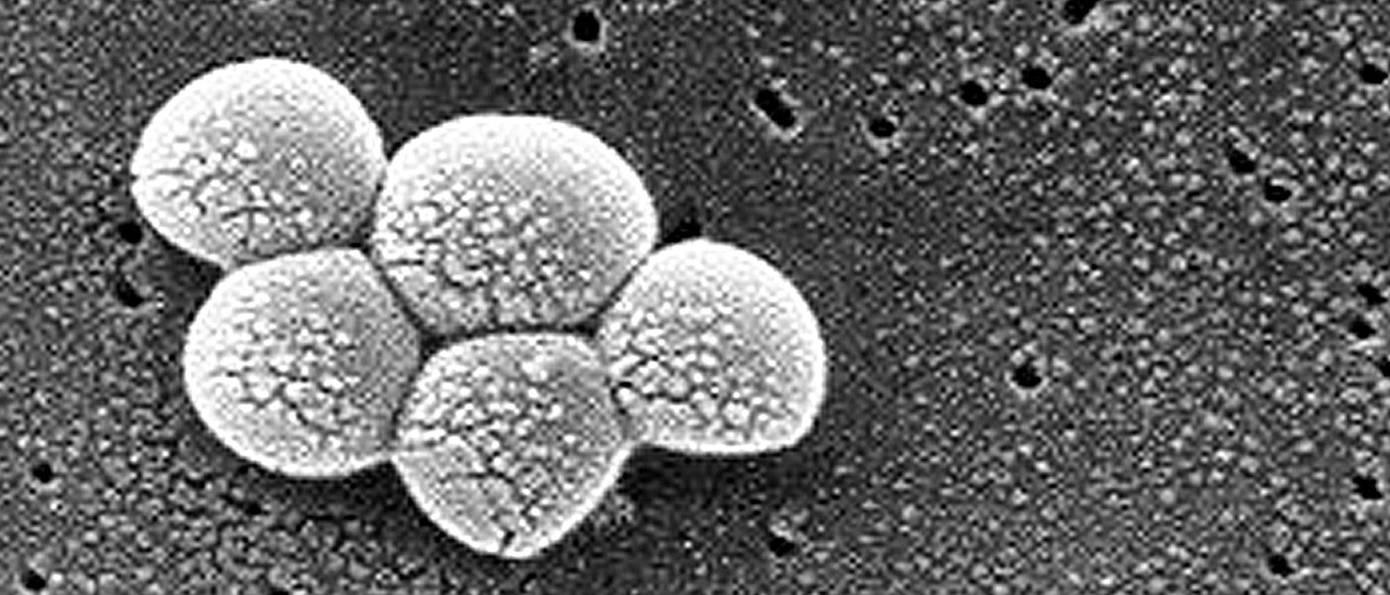 Staphylococcus aureus Staphylococcus aureus