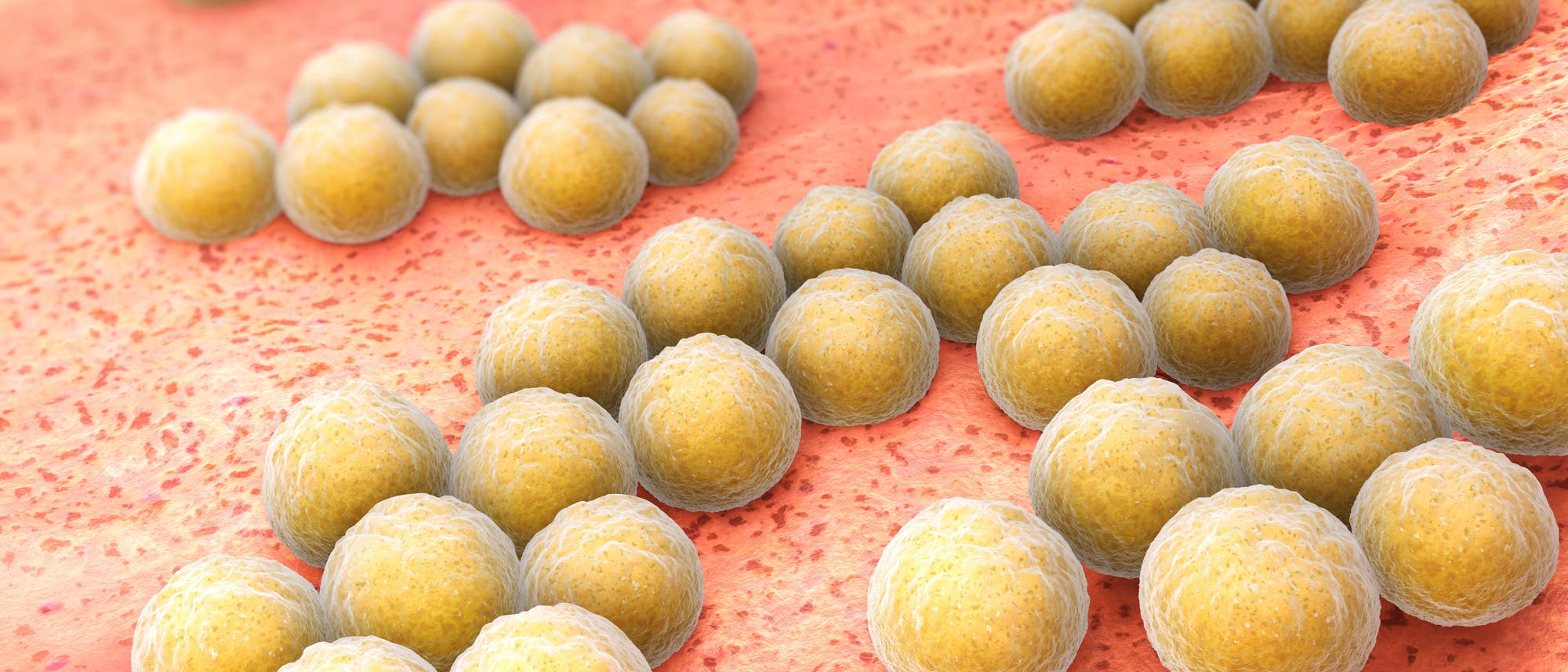 Ein Biofilm aus Staphylococcus aureus beginnt sich langsam zu bilden. Ein Biofilm aus Staphylococcus aureus beginnt sich langsam zu bilden.
