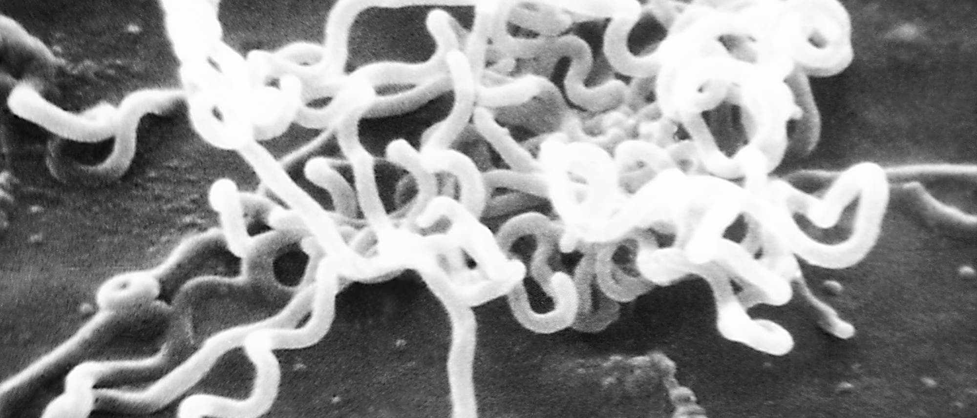 Elektrononmikroskopische Aufnahme des Syphilis-Erregers Treponema pallidum Elektrononmikroskopische Aufnahme des Syphilis-Erregers Treponema pallidum