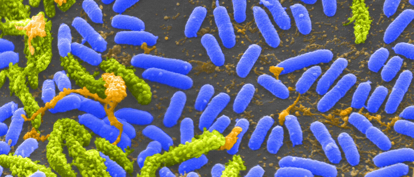 Rasterelektronenmikroskopische Aufnahme von Cholerabakterien (Vibrio cholerae; im Bild blau) Rasterelektronenmikroskopische Aufnahme von Cholerabakterien (Vibrio cholerae; im Bild blau)