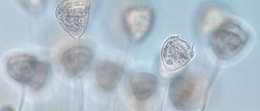 Wimpertierchen Vorticella Wimpertierchen Vorticella