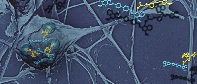 Beta-Amyloid Plaques Beta-Amyloid Plaques