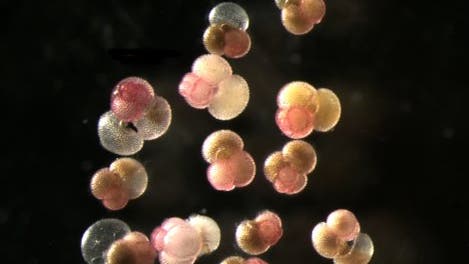 <i>Globigerinoides ruber</i>, rosafarbene Variante