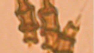 Quilonia sp., pluricellate Sporen