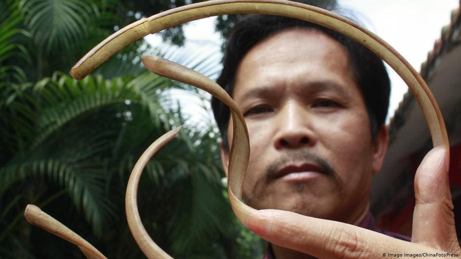 Wie Viel Wachsen Nägel In Einer Woche www.spektrum.de