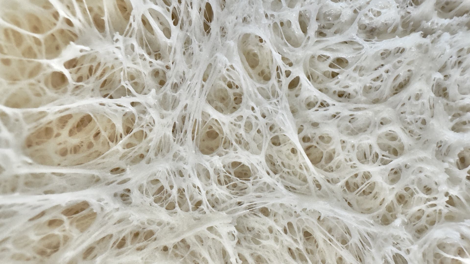 Unwahrscheinlich-t-dlich-Tod-durch-fermentierte-Lebensmittel