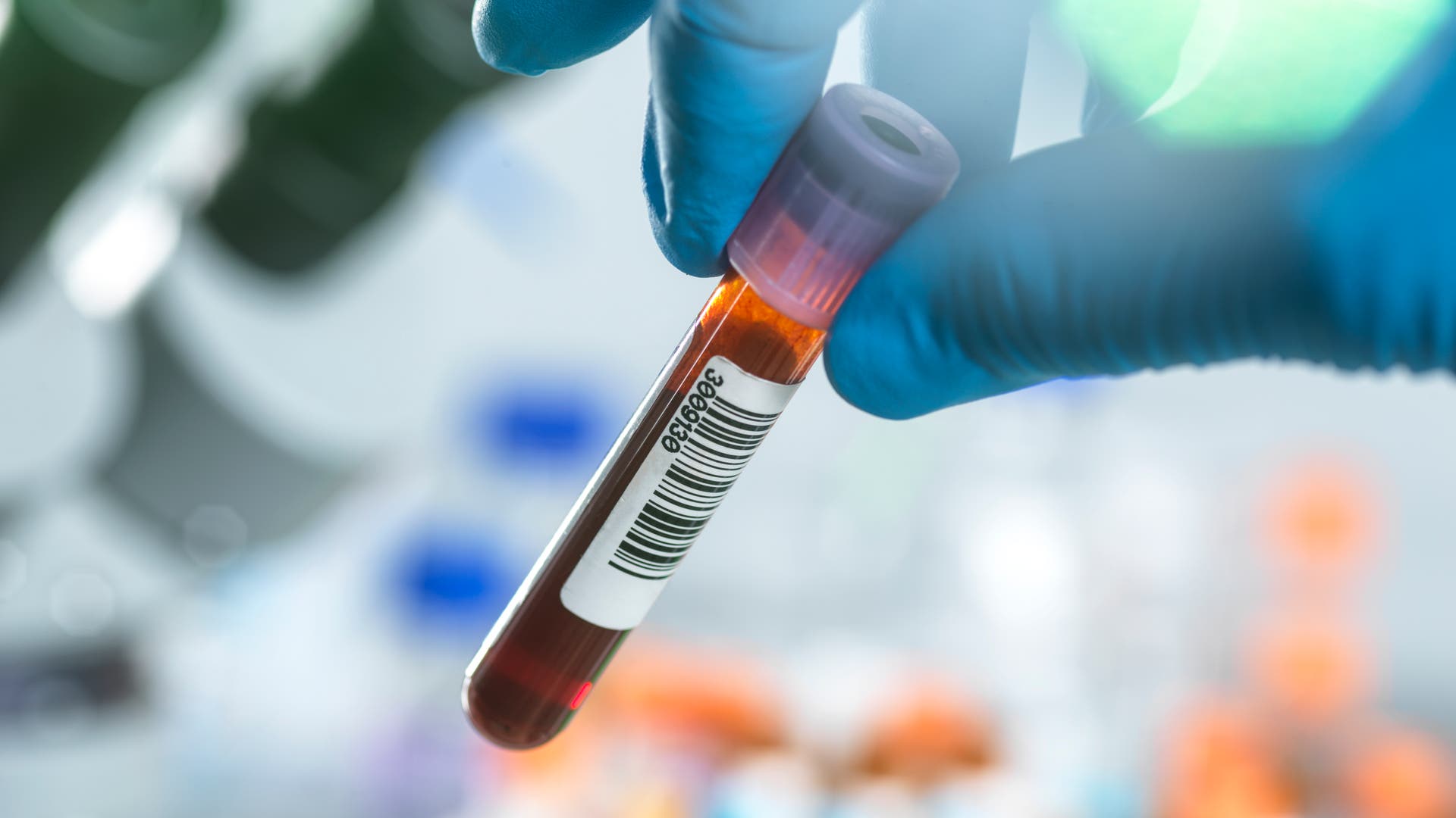 Krebs-verstehen-Kleinste-Spuren-von-Krebs-im-Blut-finden