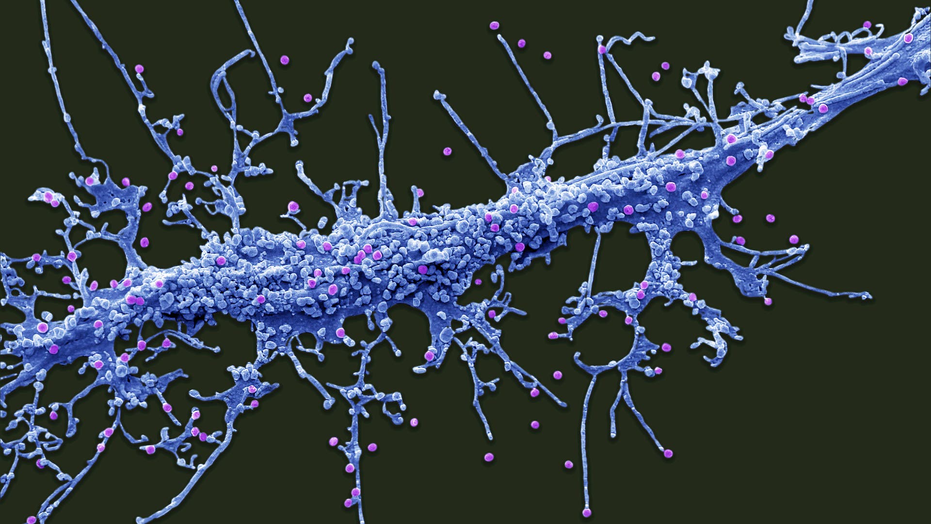 HIV-Ein-revolution-res-Aids-Medikament