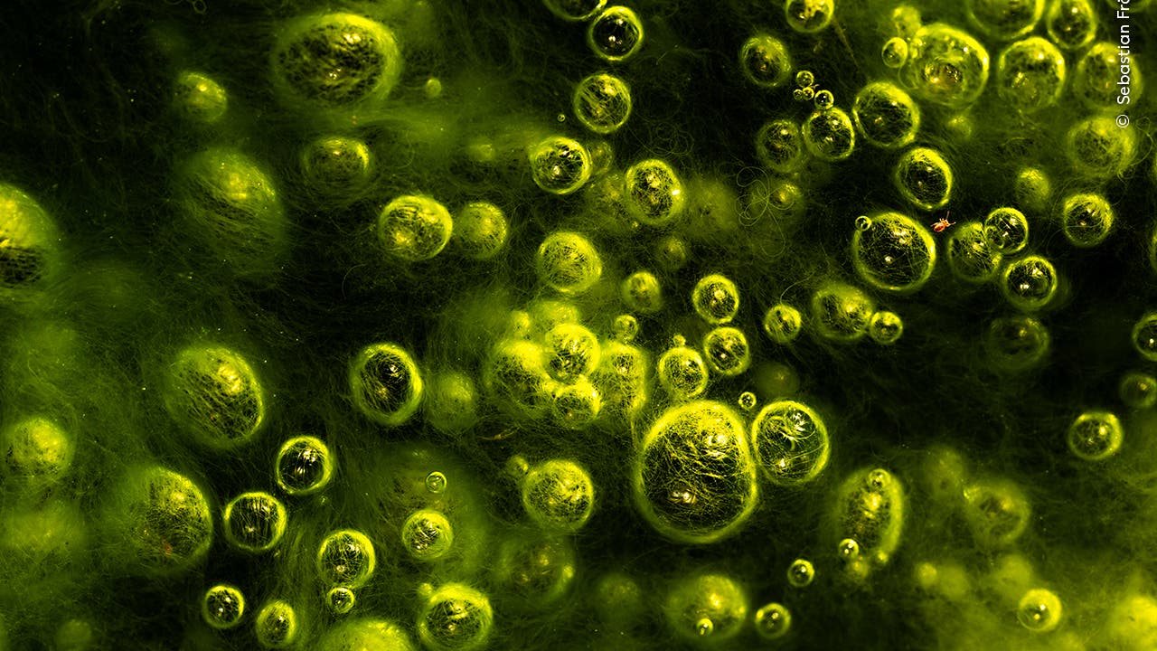 Das Fluoreszenzmikroskopbild zeigt zahlreiche hellgelbe Blasen unterschiedlicher Größe, die in einer dichten Anordnung auf einem dunklen Hintergrund verteilt sind. Die Blasen scheinen in eine flüssige oder gelartige Substanz eingebettet zu sein und erzeugen so eine dreidimensionale Textur. Die leuchtenden Farben und die Anordnung der Blasen könnten auf biologische oder chemische Prozesse hinweisen.