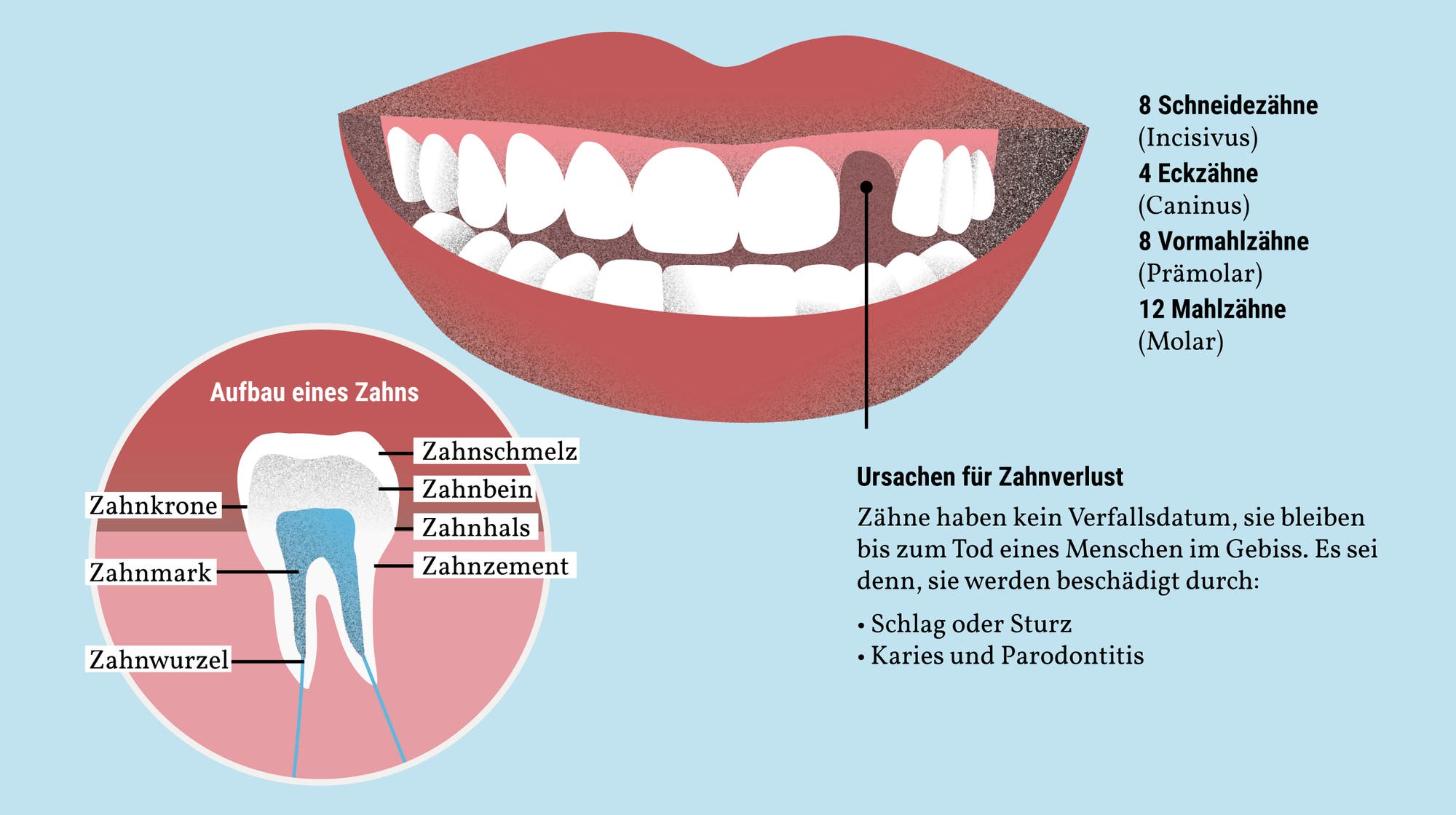 Das vollständige Gebiss eines Erwachsenen besteht aus 32 Zähnen.