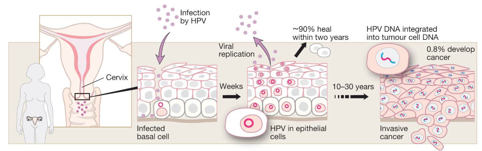 HPV-Infektion