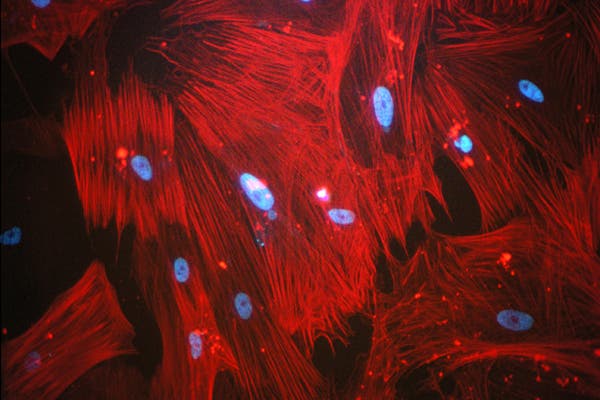 Glatte Muskulatur aus iPS-Zellen