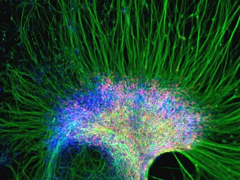 Motoneurone aus Stammzellen