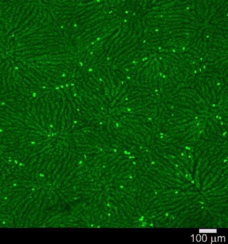 NK-Zellen in Leberkapillaren