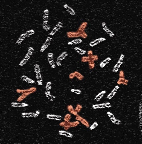 Chromosomen von Zellen ohne funktionelle <i>BRCA</i>-Gene