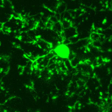 Mikrogliazelle im gesunden Gehirn