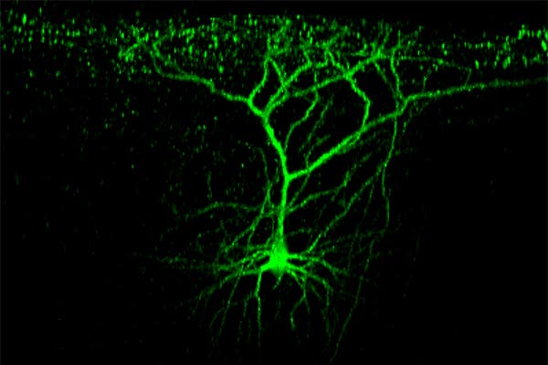 Nervenzellverbindungen
