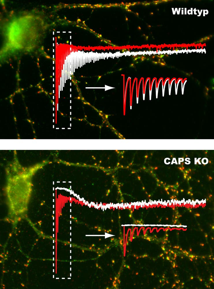 Nervenzellen mit und ohne entscheidendes Signalprotein
