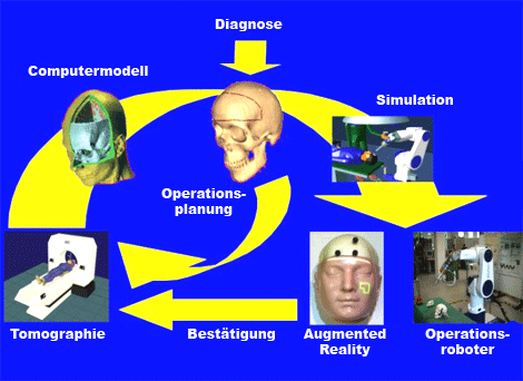 Augmented Reality: Mit Hilfe von Computertomografie und Röntgenaufnahmen wird ein Patientenmodell erstellt, an dem die Operation geplant wird.