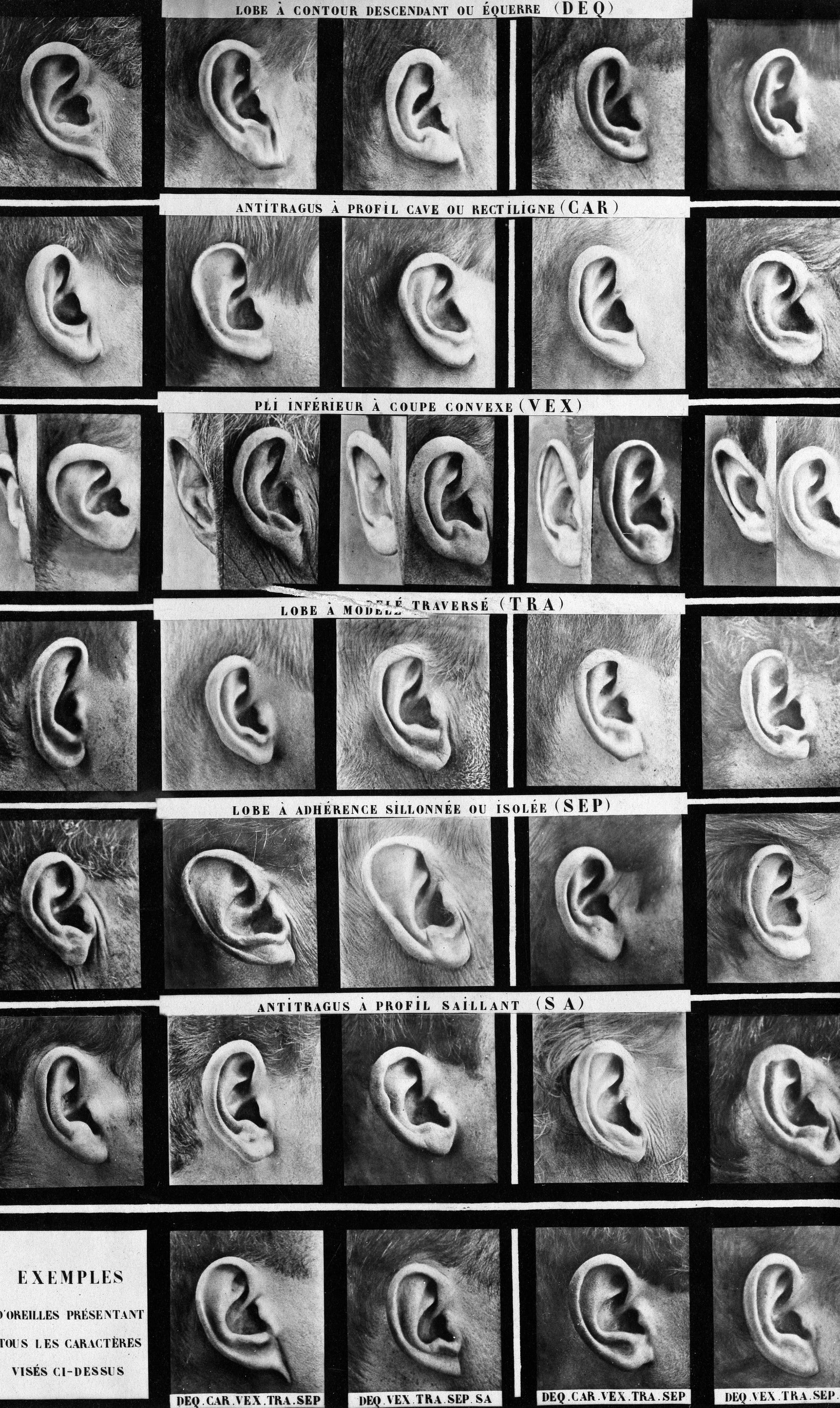 Eine Sammlung von Abbildungen unterschiedlicher Ohrenformen samt Klassifizierung