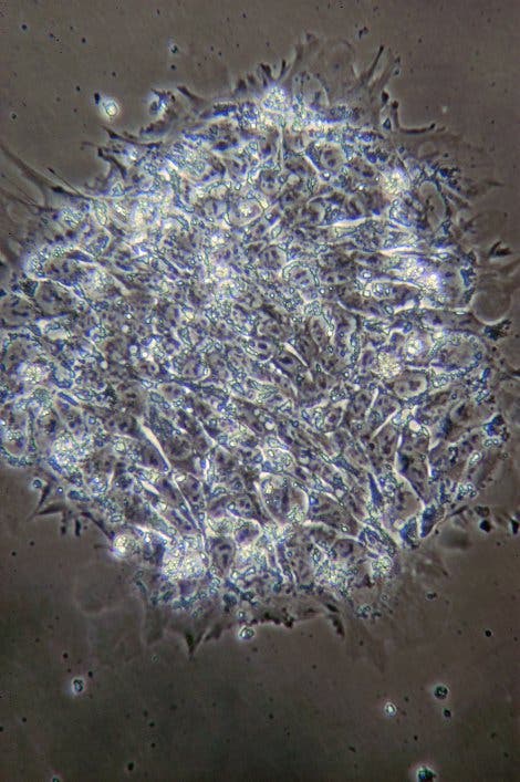 Embryonale Stammzellen