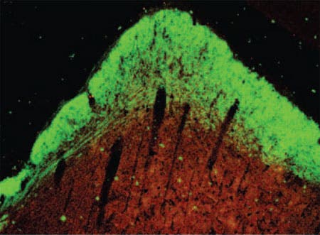 Nerven-Regeneration im Hamsterhirn