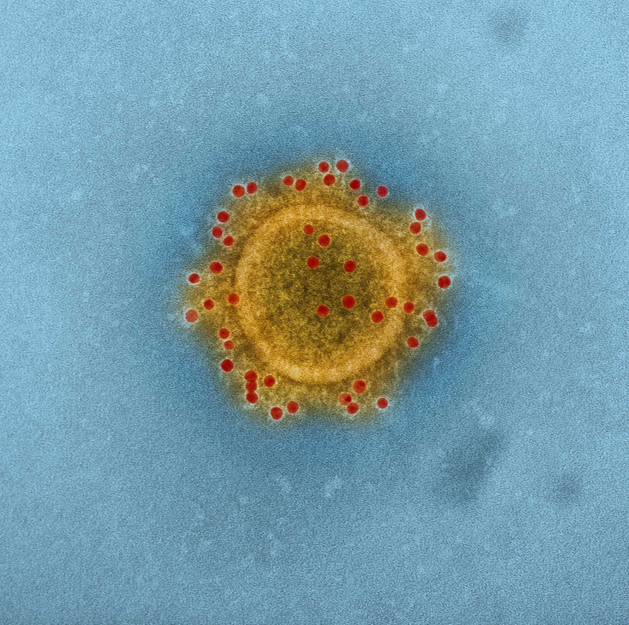 MERS-Coronavirus