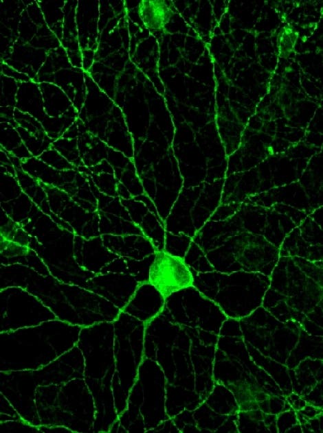 Transformierte Ganglionzelle der Retina