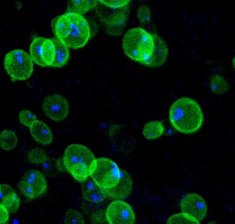 Für die Zellteilung: fluoreszierende Mikrotubuli