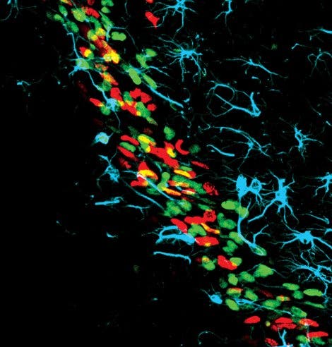 Neuronale Vorläuferzellen