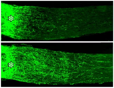 Regeneration eines Neurons