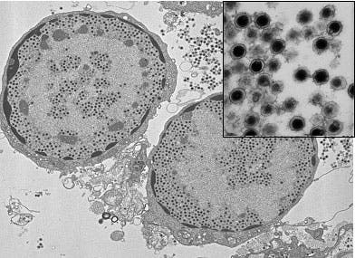 Das <i>Panulirus-argus</i>-Virus 1 unter dem Elektronenmikroskop