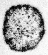 Das Masernvirus