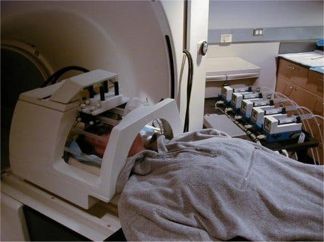 Hirn-Scan im MRI-Gerät