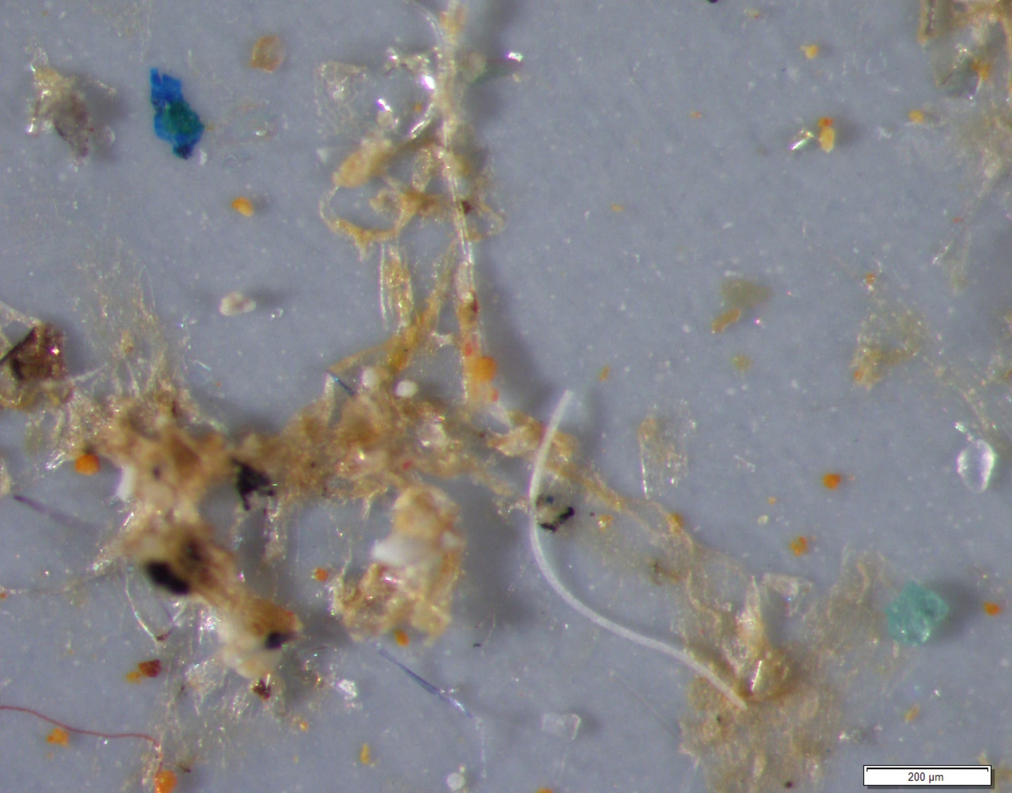 Verschiedene Plastikpartikel nach der Analyse