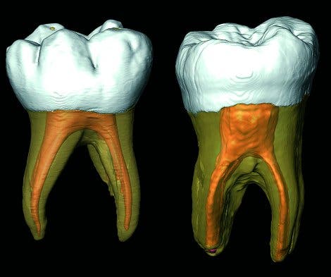 Neandertaler-Zähne