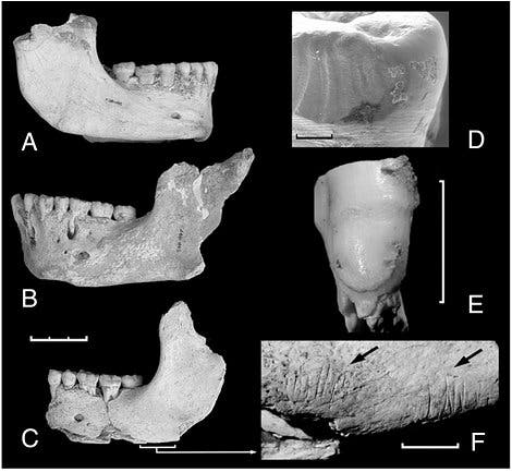 Unterkiefer und Zähne von El Sidrón