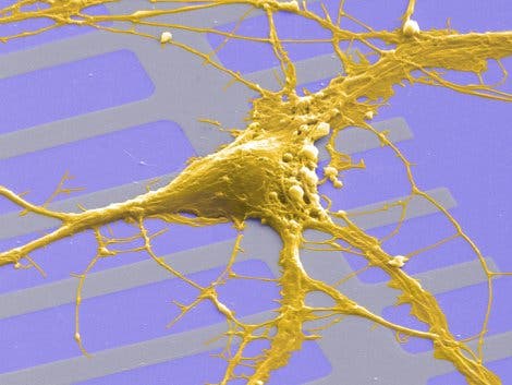 Neuron auf Siliziumchip