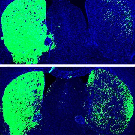 In Mäusegehirnen lassen sich Astrozyten zu dopaminergen Neuronen umprogrammieren