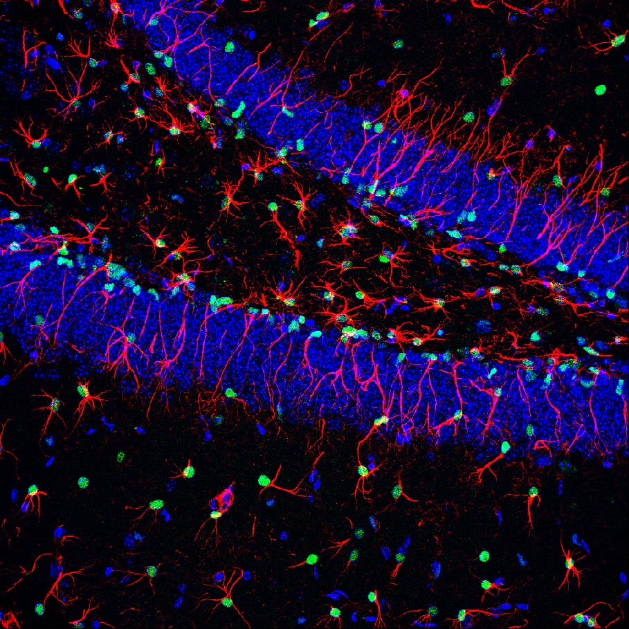 Neuronale Stammzellen