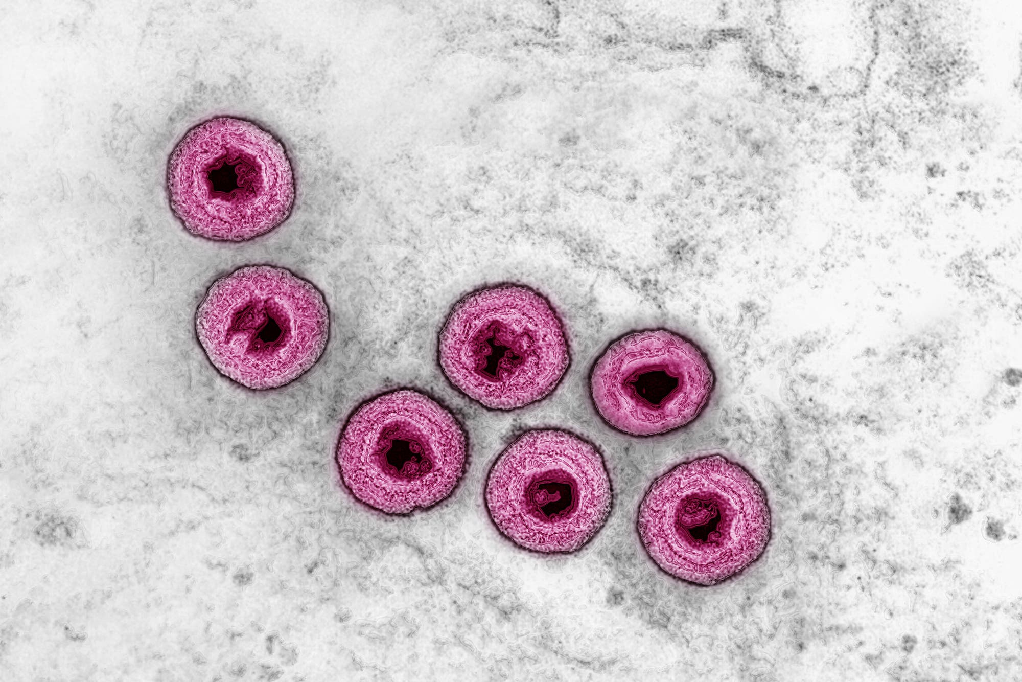 Elektronenmikroskopische Aufnahme von sieben Herpesviren, die in einer Gruppe angeordnet sind. Die Viren sind rund und in einem auffälligen Rosa gefärbt, mit einer dunkleren Mitte. Der Hintergrund ist grau und strukturiert. Diese Darstellung zeigt die Struktur der Viren detailliert.