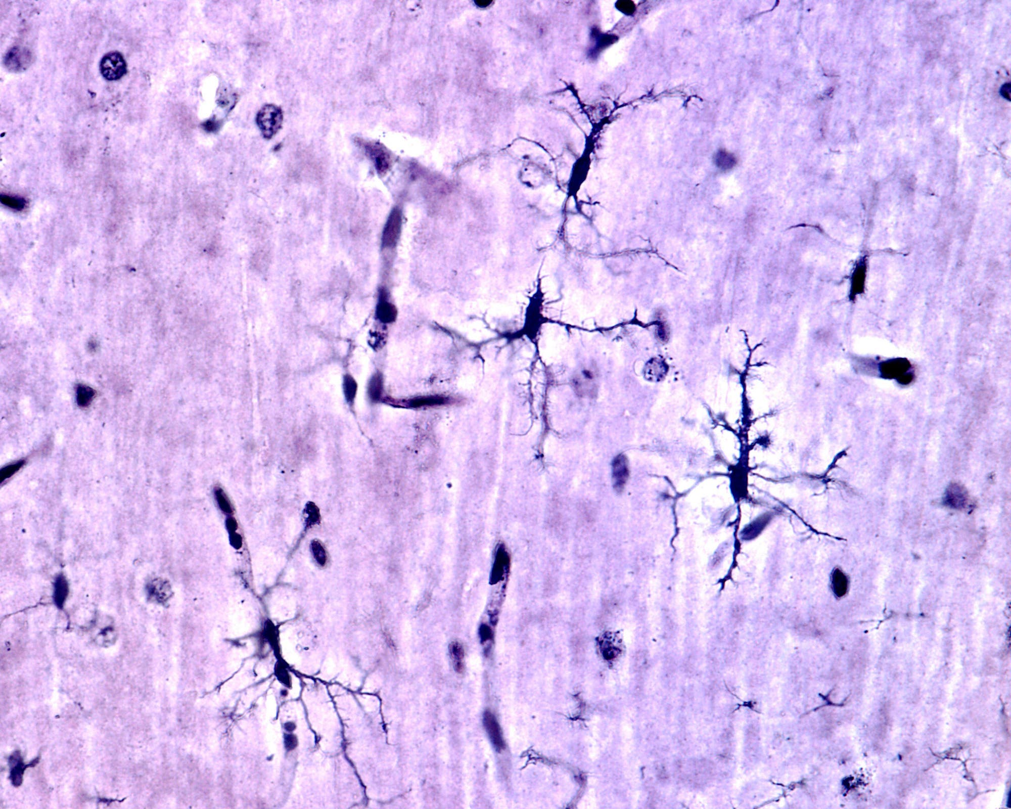 Mikroskopische Aufnahme von Mikrogliazellen im Gehirn, die als dunkle, verzweigte Strukturen mit vielen Fortsätzen auf einem hellvioletten Hintergrund erscheinen.