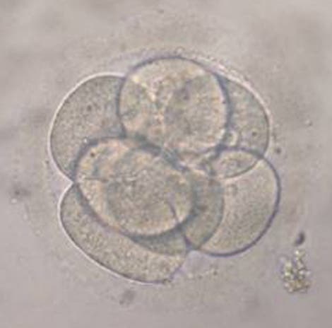 Angeblich geklonter Embryo